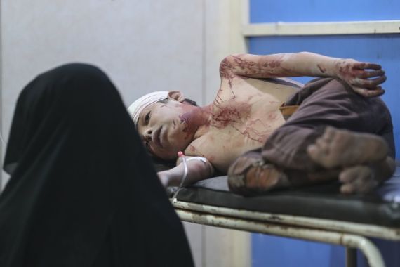 طفل سوري مصاب في قصف للنظام على إدلب شمالي البلاد