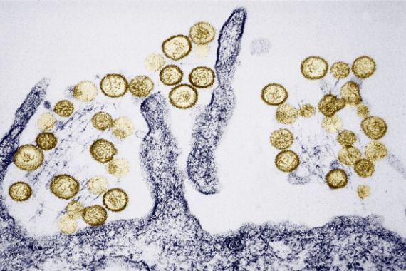 صورة لأحد أنواع فيروس هانتا تحت الميكروسكوب