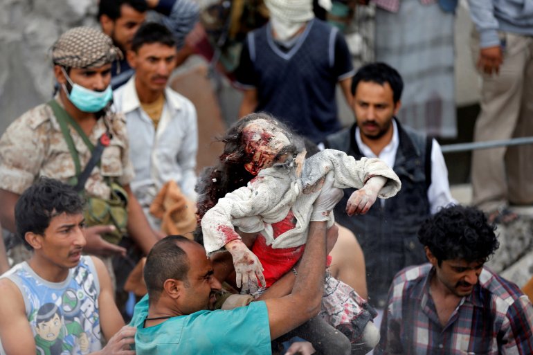 الطفلة بثينة محمد منصور بعد انتشالها من تحت الأنقاض عقب قصف قوات التحالف العربي لصنعاء