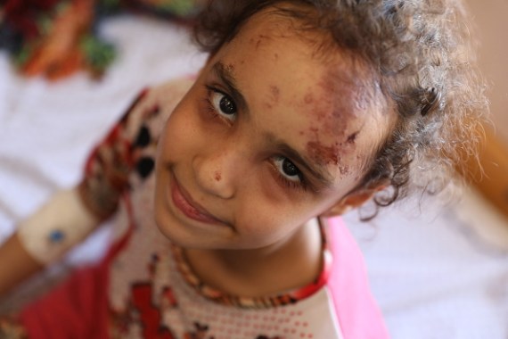 الأطفال في قطاع غزة تعرضوا لصدمة نفسية جراء العدوان الإسرائيلي الأخير