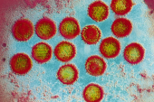صورة مجهرية إلكترونية ملونة لجزيئات فيروس إبستين- بار (مواقع إلكترونية)