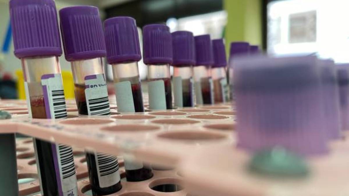 Monkeypox.. La France intensifie sa campagne de vaccination alors que les infections augmentent et un pays africain enregistre son premier cas depuis 2018 |  Messages avec les sages