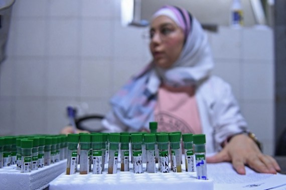 مرض الكوليرا يصيب مناطق متنوعة في سوريا